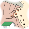 （イラスト）がけ崩れ・山崩れ